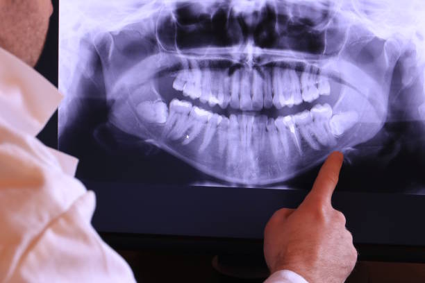 Best Broken or Cracked Tooth Emergency Dentist in Old Jamestown, MO