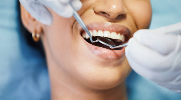 Best Emergency Dental Services for Seniors in Old Jamestown, MO