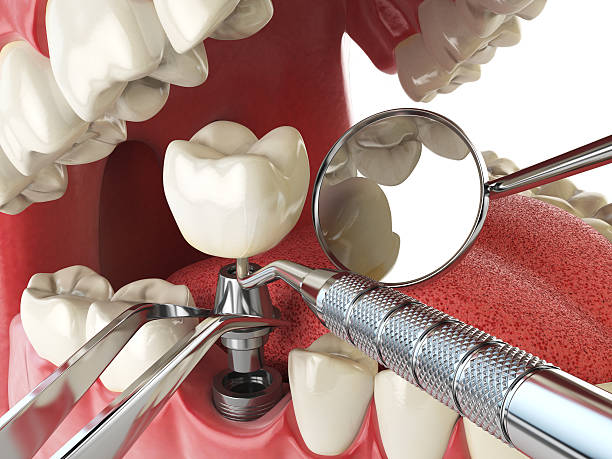 Best Emergency Dental Services for Seniors in Old Jamestown, MO